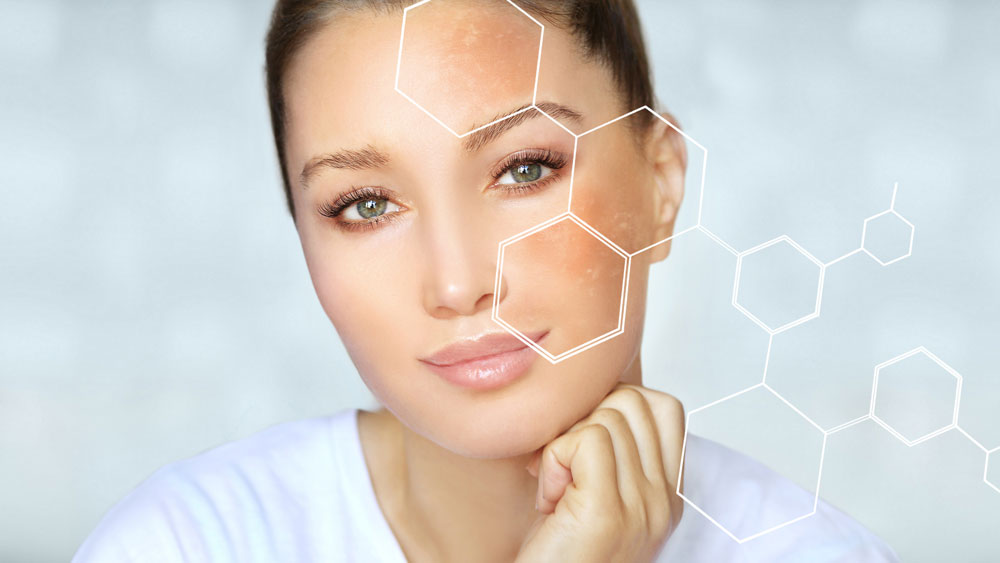 Terapia łączona Melano STOP